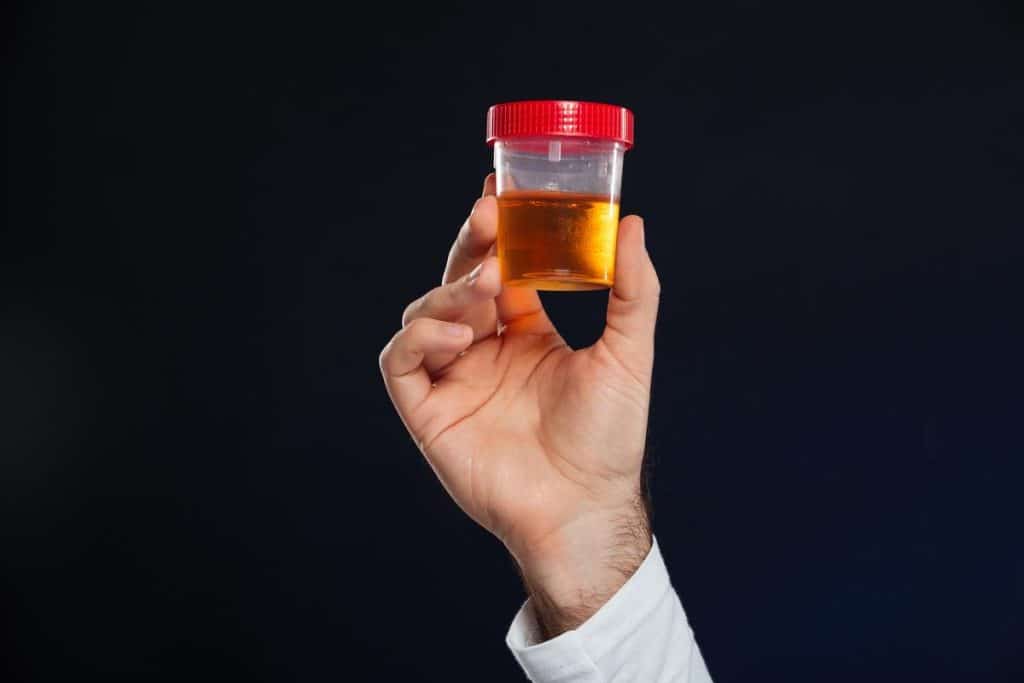 urine fluorescent