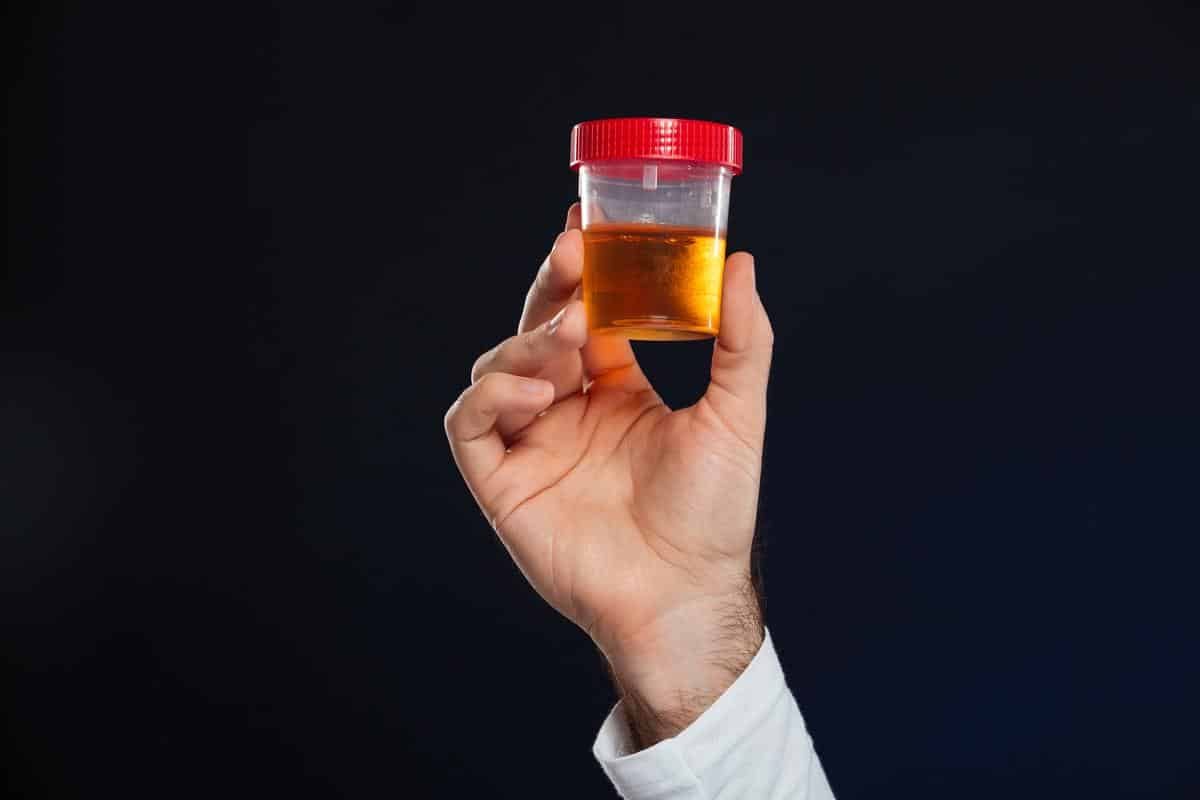 urine fluorescent